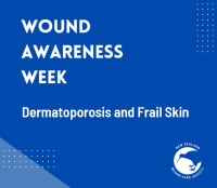 ZOOM - Dermatoporosis - frail skin